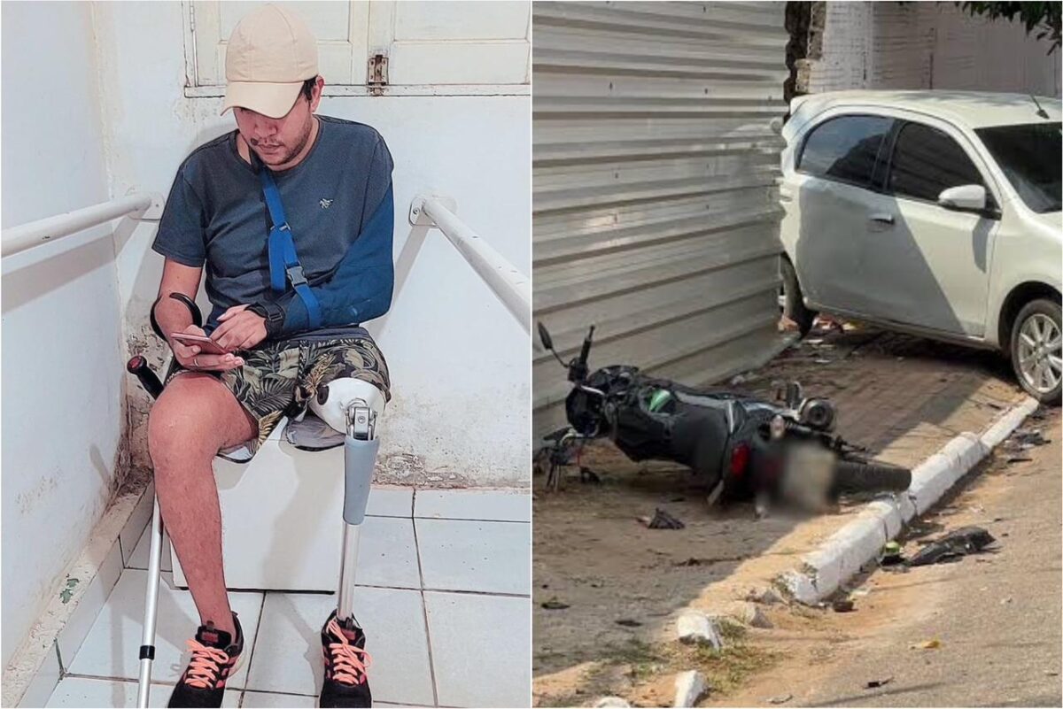 Jovem que teve perna amputada em acidente e perdeu movimento de braço pede ajuda para se manter Jovem que teve perna amputada em acidente e perdeu movimento de braço pede ajuda para se manter
