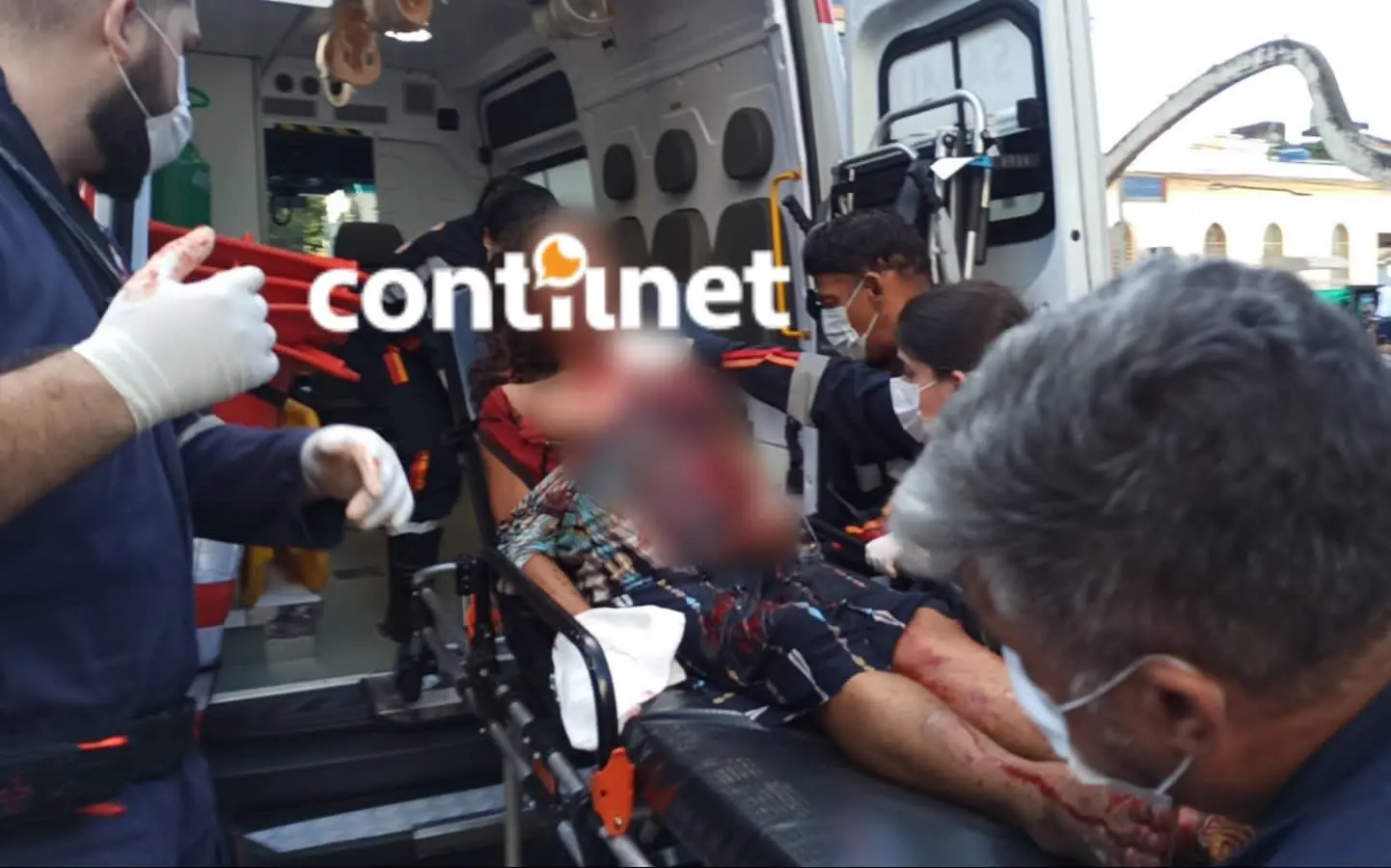 Travesti quase é degolada enquanto dormia em via pública; estado dela é grave