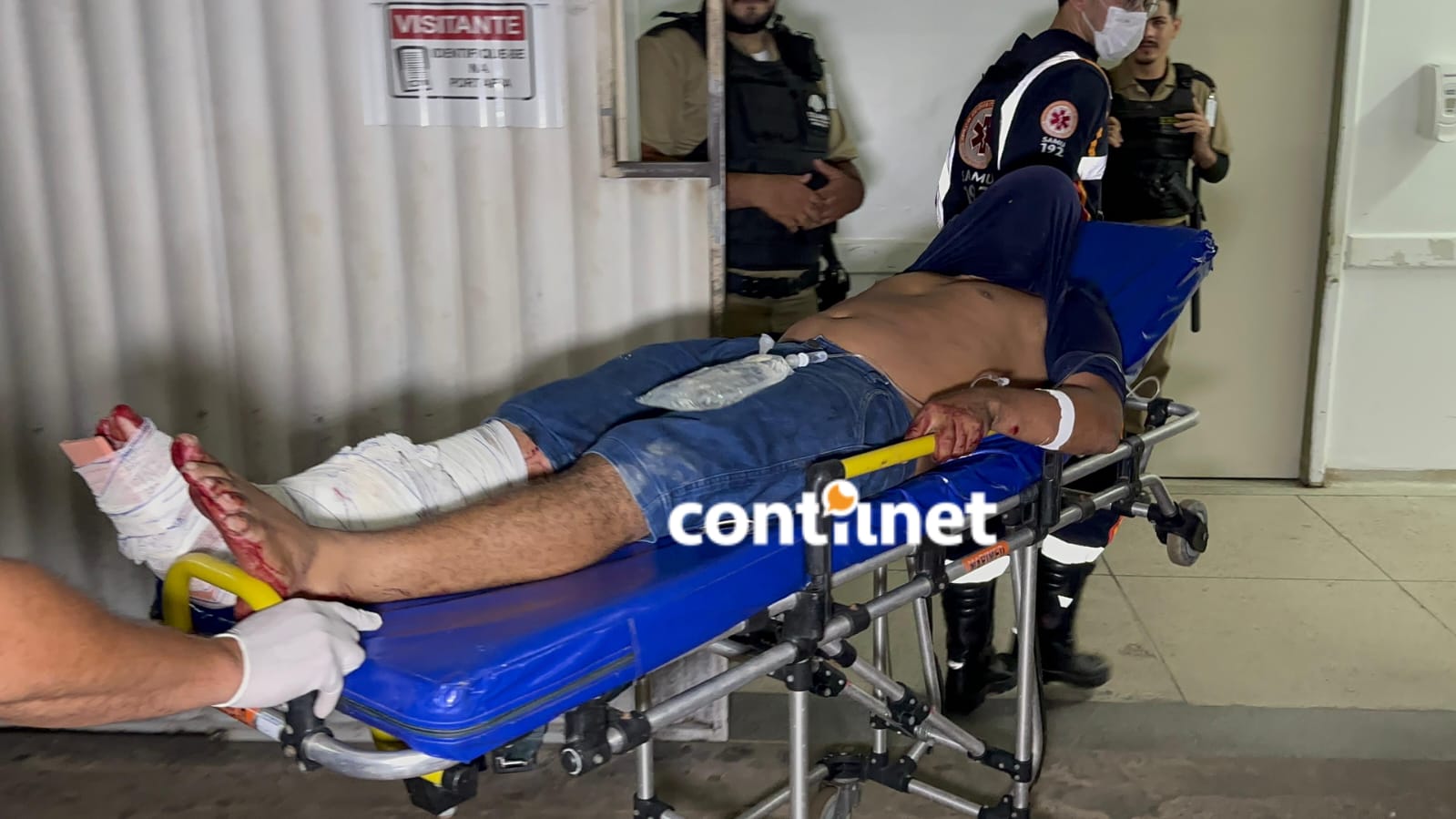 Criminosos passam atirando e deixam homem ferido no 2º Distrito de Rio Branco