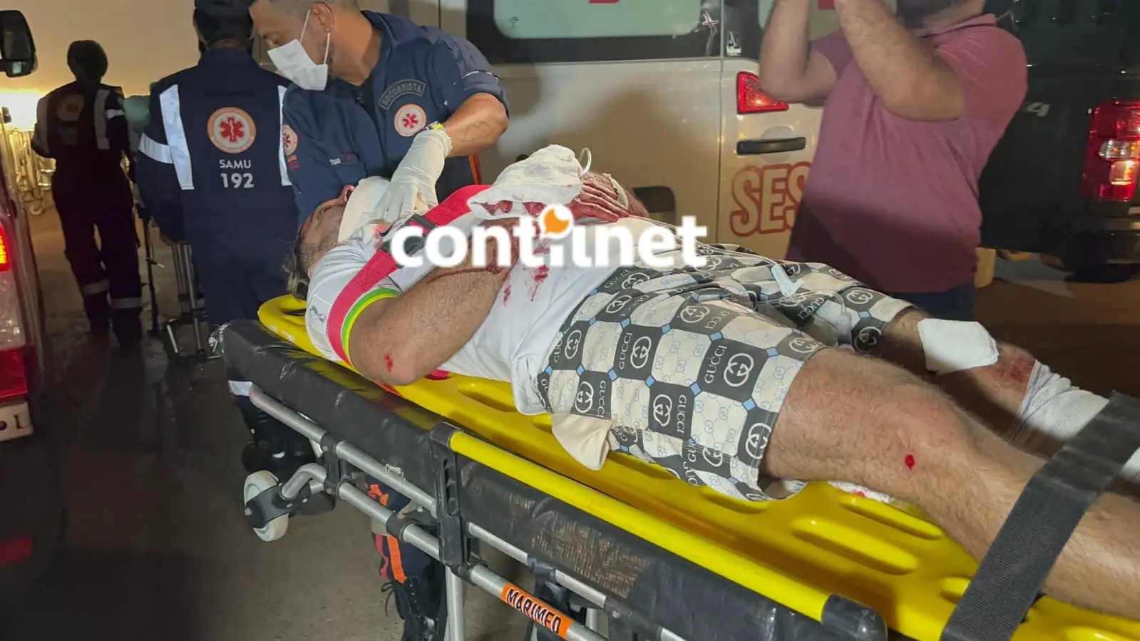 Motos colidem de frente e deixam duas pessoas gravemente feridas com fratura exposta