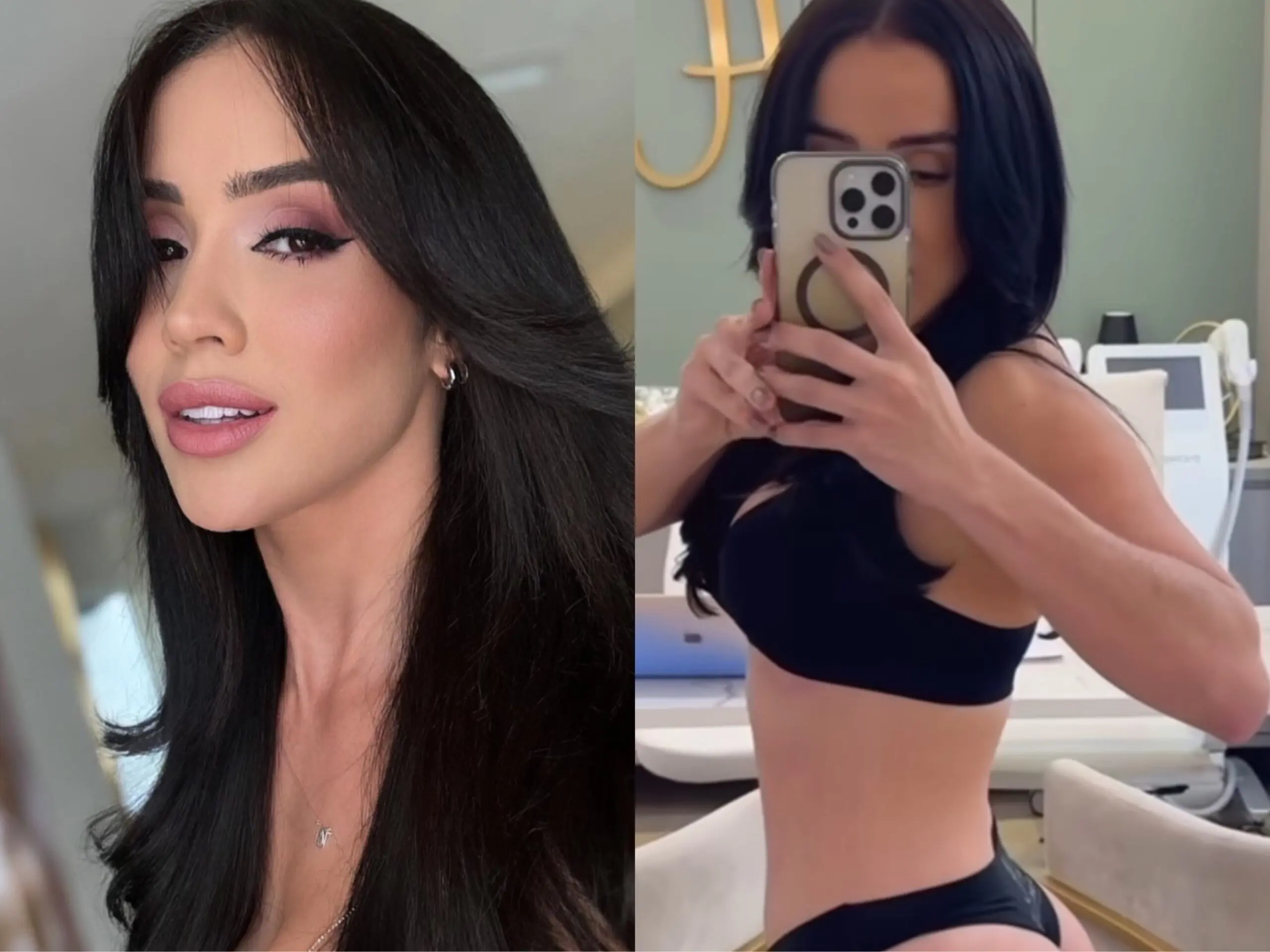 Em vídeo, Juh Vellegas exibe resultado de harmonização do bumbum: “Super redondinho”