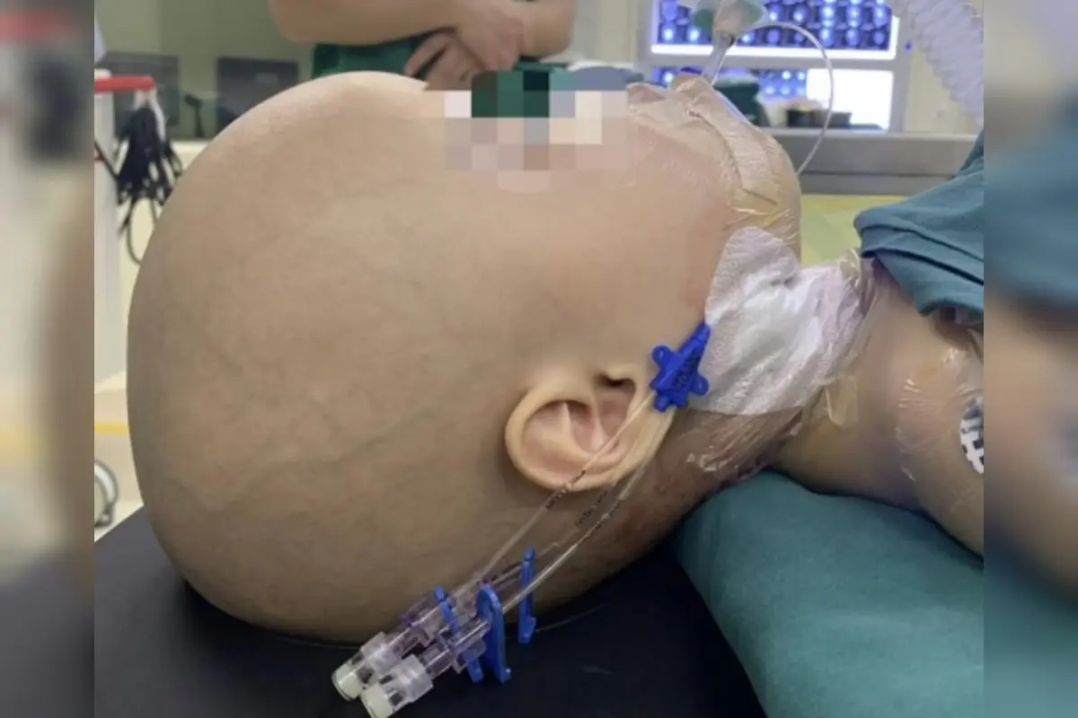 Médicos encontram feto com braços dentro do crânio de bebê de 1 ano