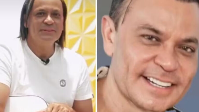 Frank Aguiar revela novo procedimento estético: “carinha de 33”