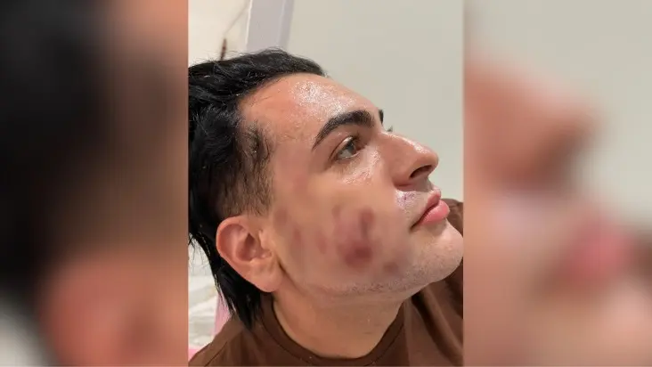 Homem de 27 anos morre durante ‘peeling de fenol’ em clínica de estética