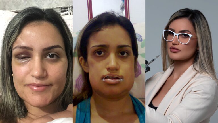 Exclusivo: biomédica do Acre com síndrome rara lança clipe inspirado em sua história; ASSISTA