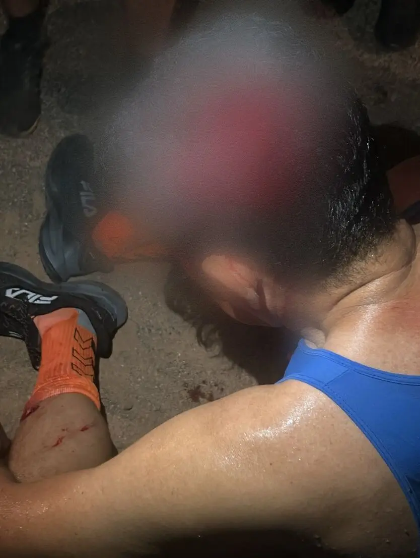 Professor sofre traumatismo craniano após ser atropelado durante caminhada