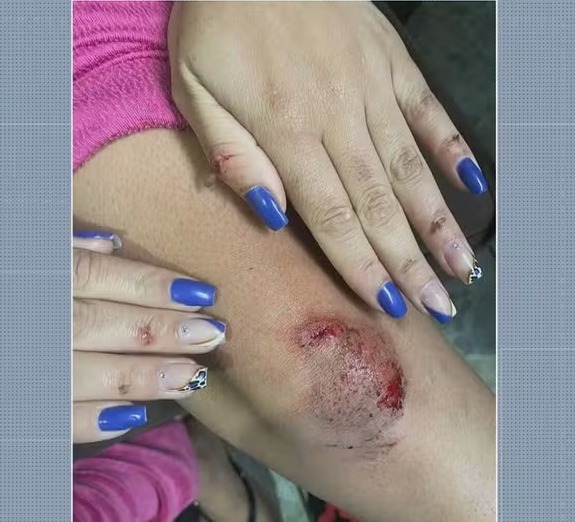 Jovem é atacada por motorista de aplicativo e pula do carro em movimento para fugir de abuso