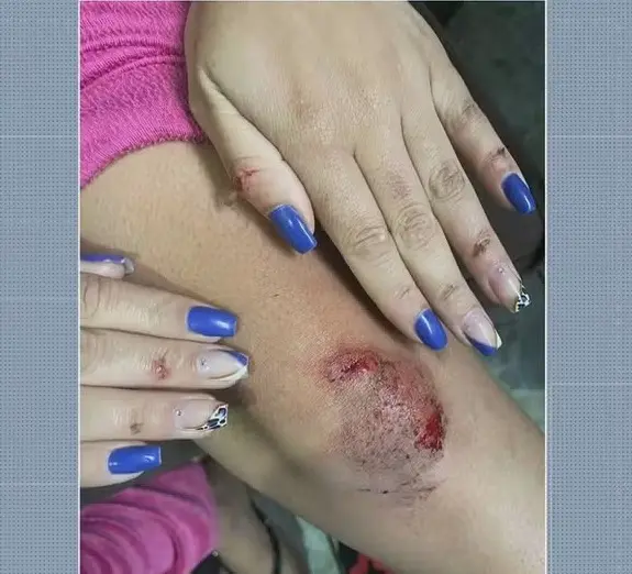 Jovem é atacada por motorista de aplicativo e pula do carro em movimento para fugir de abuso