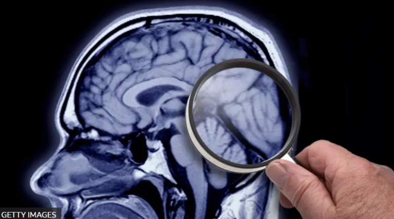 As células que protegem, mas também podem destruir nosso cérebro As células que protegem, mas também podem destruir nosso cérebro