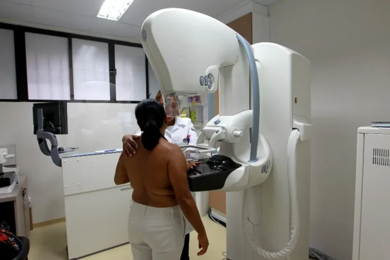 Acre tem um dos menores tempos de espera por mamografia no país