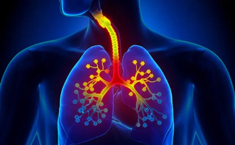 MĂ©dica acreana alerta sobre os perigos da bronquite: âPode evoluir para pneumonia graveâ