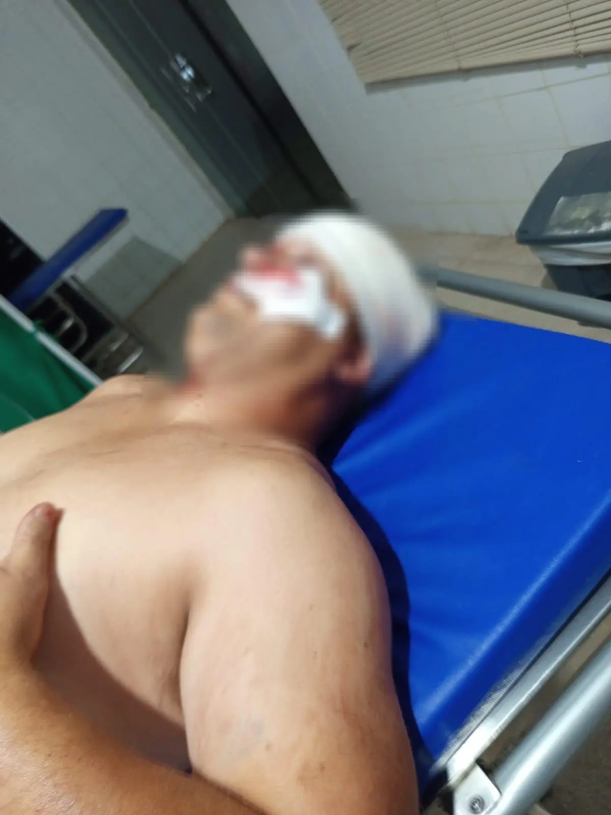 Caminhoneiro de Santa Catarina é baleado com tiro no rosto em cidade no interior do Acre