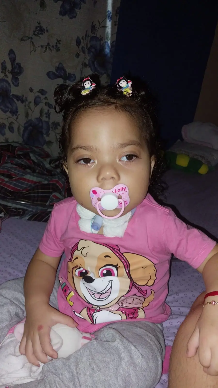 Rifa solidária com três prêmios arrecada fundos para tratamento de Helena, criança com condição rara