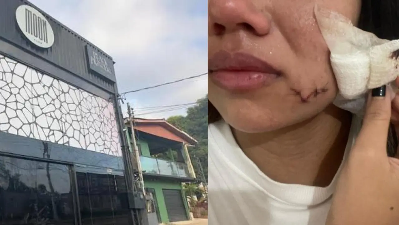 Jovem que levou garrafada na Moon quebra o silêncio e diz que não recebeu ‘qualquer ajuda’ da boate