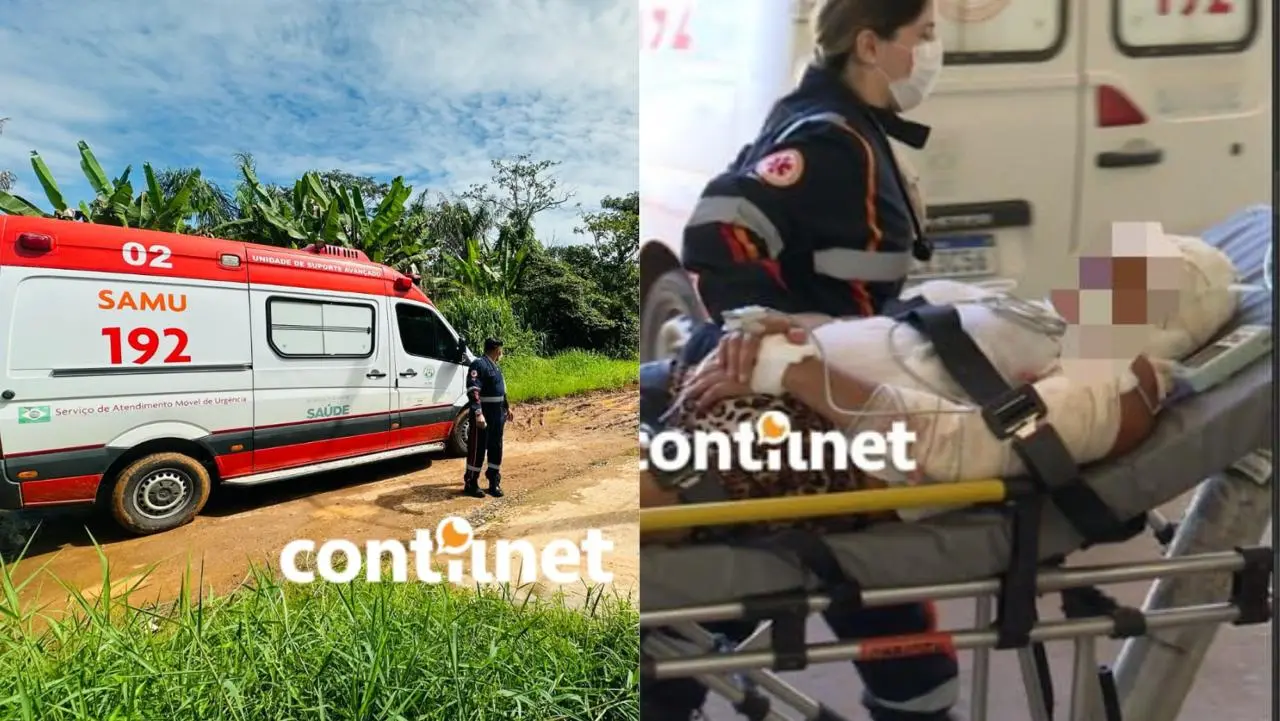Casal é violentamente atacado por cães Rottweiler que se soltaram em Rio Branco