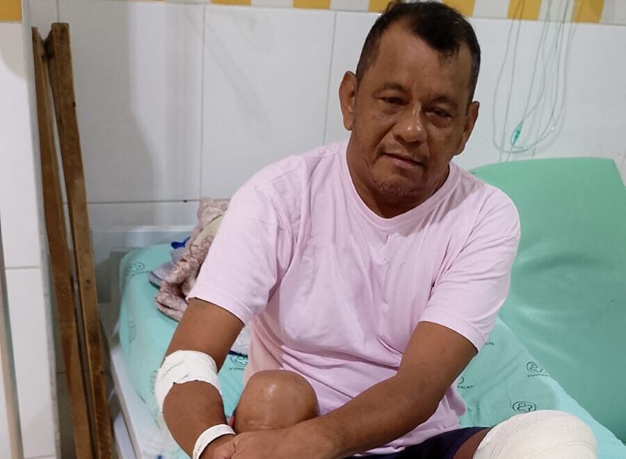Amigos se mobilizam para evitar que Cowboy de Sena perca a perna após acidente; saiba como ajudar