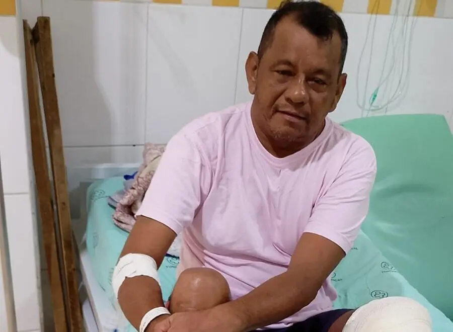 Amigos se mobilizam para evitar que Cowboy de Sena perca a perna após acidente; saiba como ajudar