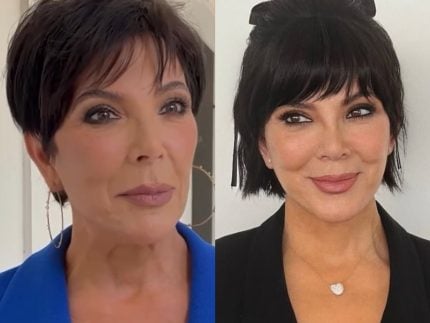 mae-das-kardashians-teria-buscado-“mestre-do-lifting-facial”-para-renovar-o-visual