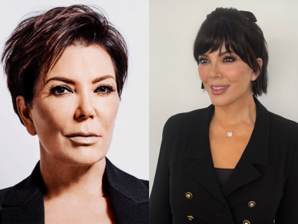 Rejuvenescimento natural? Especialista comenta caso da mãe das Kardashians