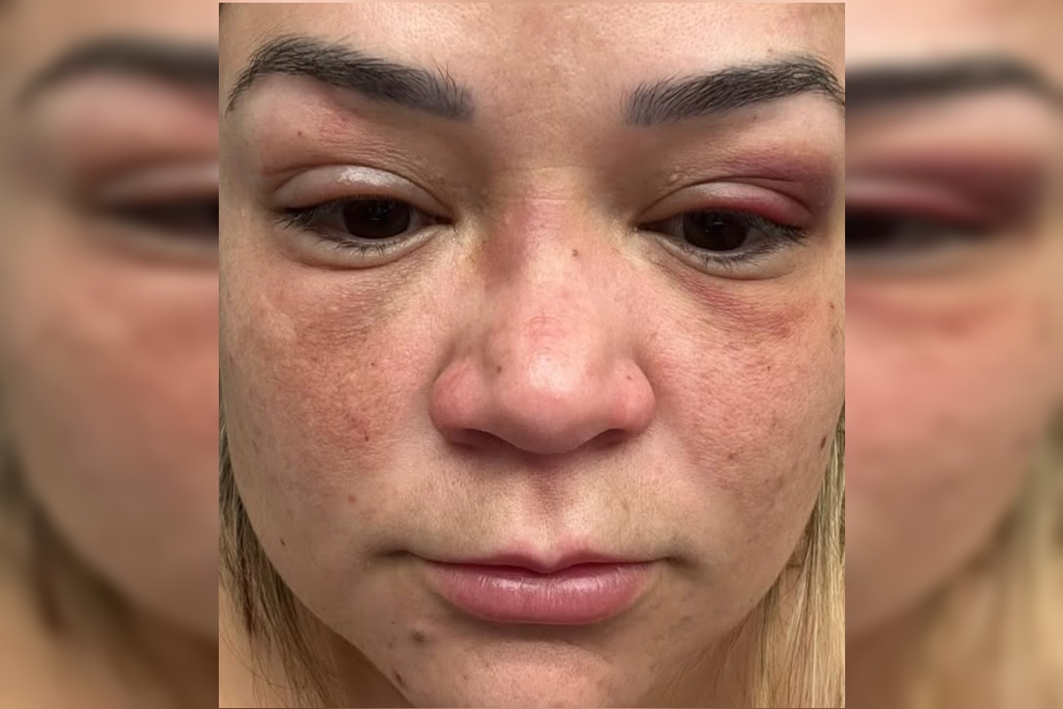 advogada-presa-por-agressao-se-defende-e-mostra-fotos-de-lesoes:-veja