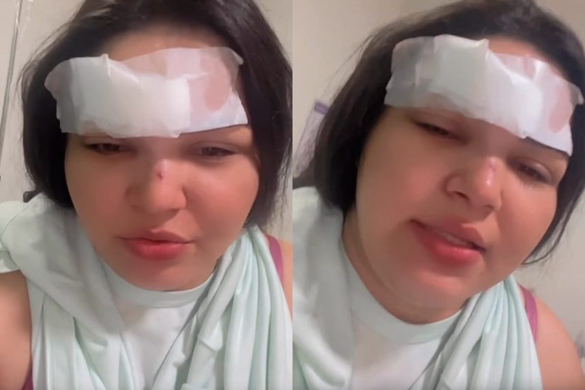 cantora-tem-testa-cortada-por-garrafa-em-briga-motivada-por-ciumes