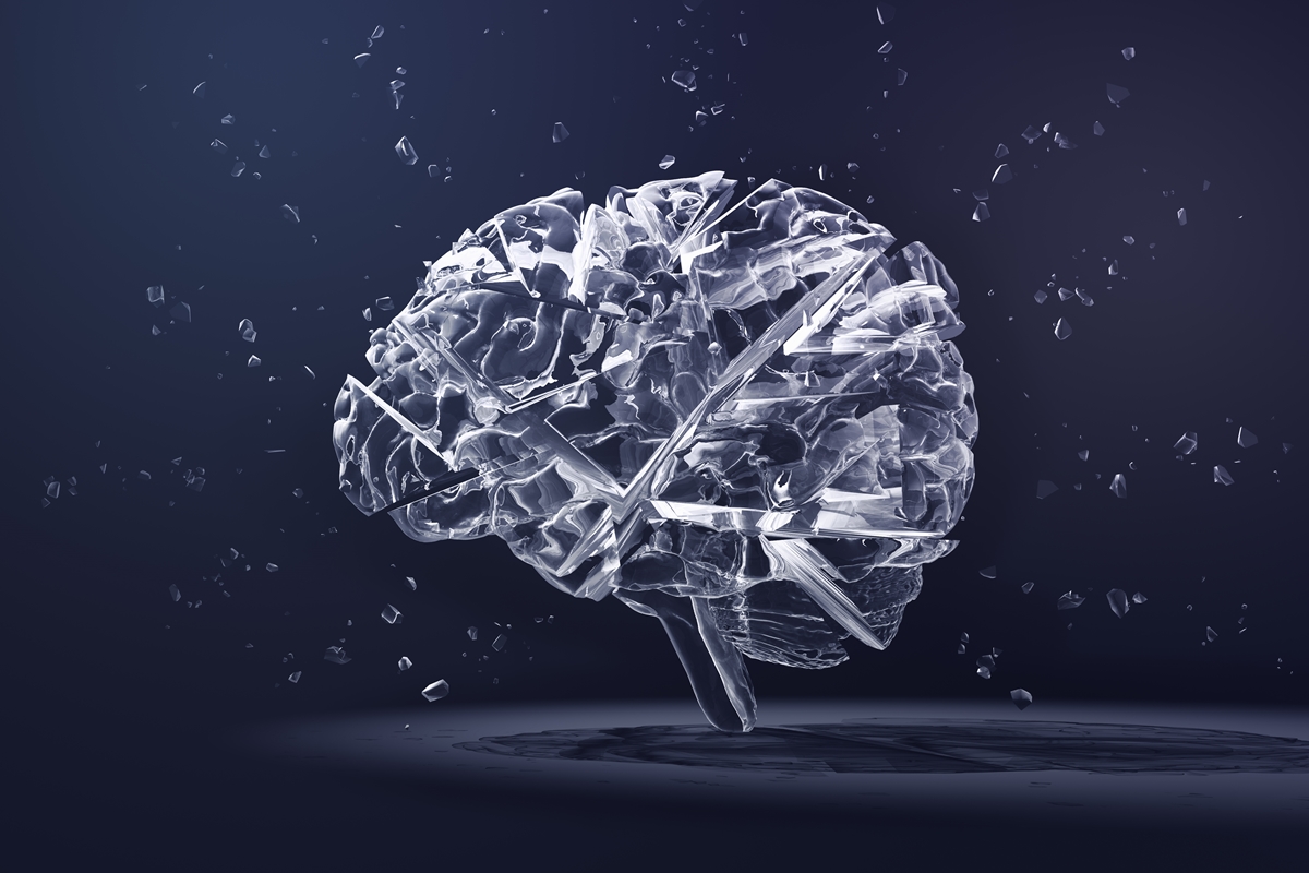 sintomas-de-avc:-saiba-sinais-iniciais-que-podem-passar-despercebidos