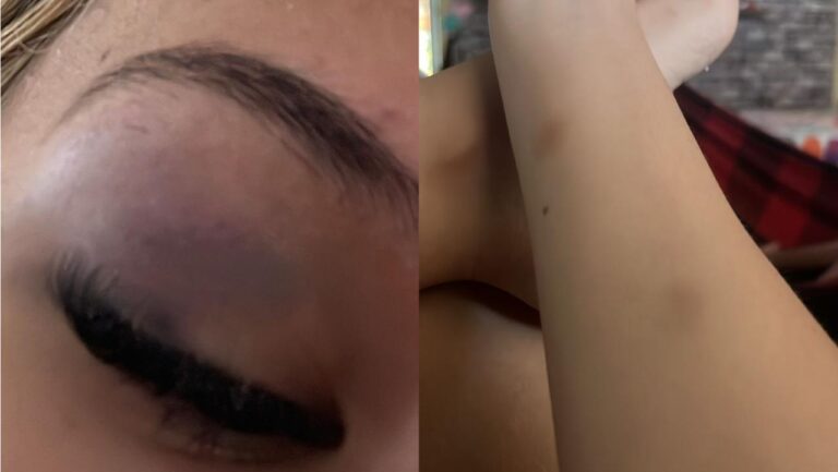 Alunas denunciam agressão e ameaças em escola de Rio Branco: ‘Tua mãe vai chorar no teu caixão’