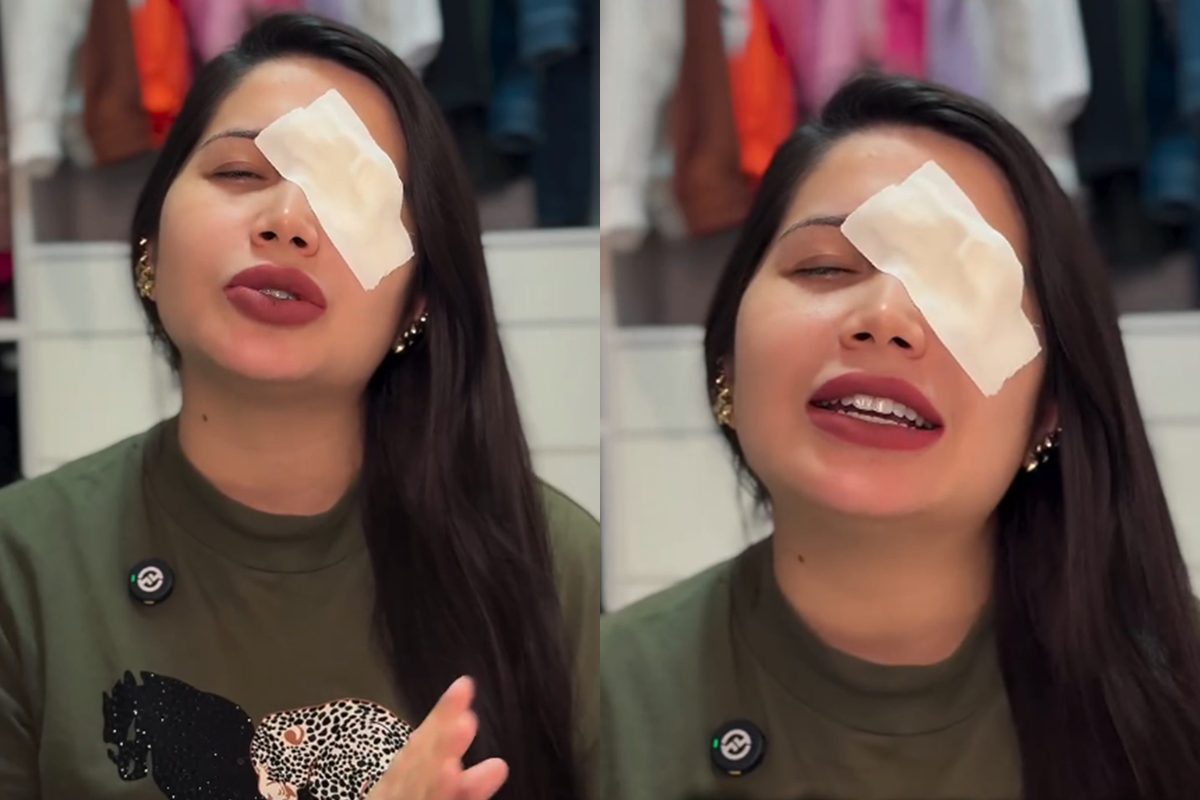 influencer-tem-hemorragia-ocular-apos-usar-lentes-vencidas-em-trend