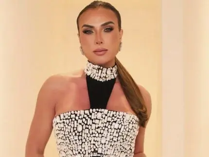 Nicole Bahls investiu cerca de R$ 100 mil em lipoaspiração; veja antes e depois