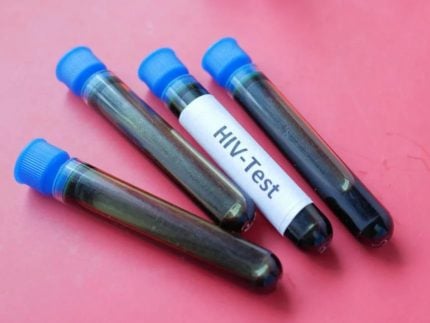 cientistas-registram-avanco-tido-como-“impossivel”-na-busca-pela-cura-do-hiv.-entenda!