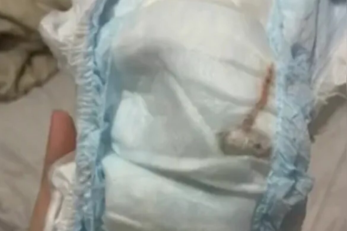 rio:-“rato”-encontrado-em-fralda-de-bebe-era-um-pedaco-de-plastico