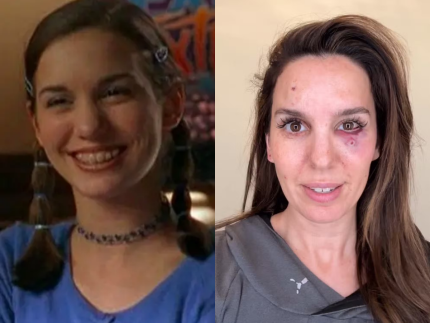 tiro-no-rosto-e-medo-da-morte:-ex-estrela-da-disney-relembra-trauma-em-festa