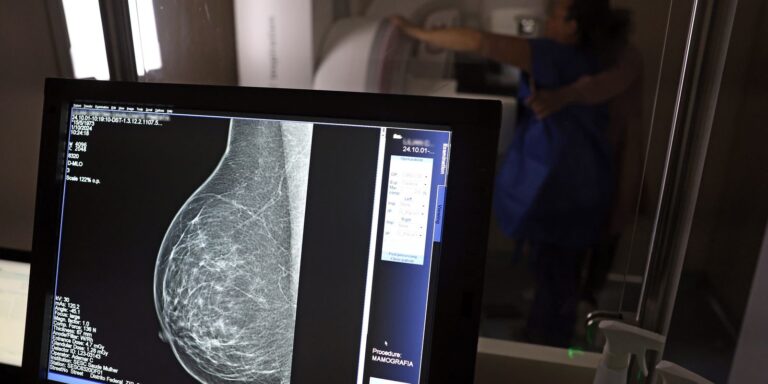 Câncer de mama: uma em cada três pacientes tem menos de 50 anos