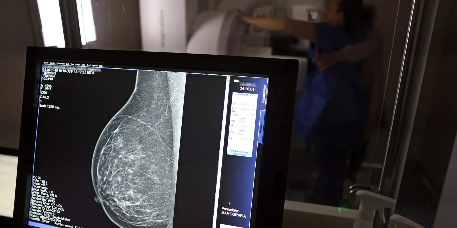 Câncer de mama: uma em cada três pacientes tem menos de 50 anos