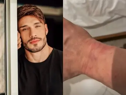 Campeão de “A Fazenda”, Lucas Viana aparece ferido e diz ter sido detido em Dubai