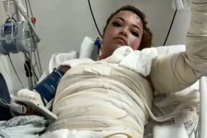 Jovem morre após sair de banheira de motel com queimaduras graves