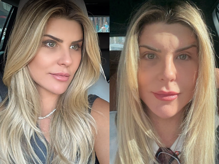“nao-sou-doente-com-vaidade”,-diz-iris-stefanelli-apos-plastica-para-rejuvenescer-o-rosto