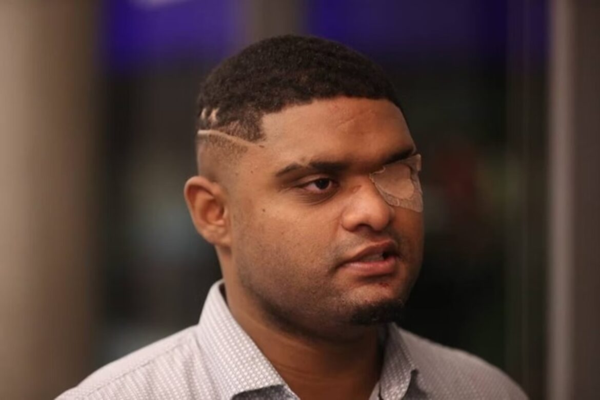 jovens-que-arrancaram-olho-de-rapaz-autista-serao-julgados-nesta-5a