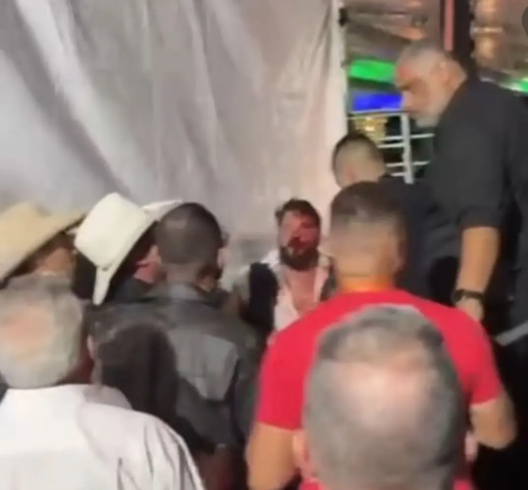 Cantor relata agressão por produtor de Eduardo Costa em show em GO: “Covarde”
