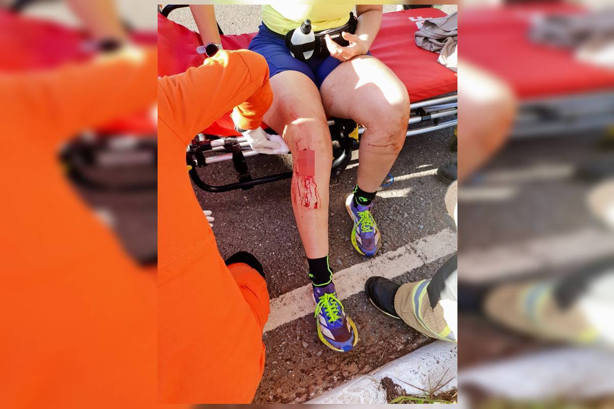 video:-medica-teve-sangramento-abundante-apos-ser-atacada-por-10-caes