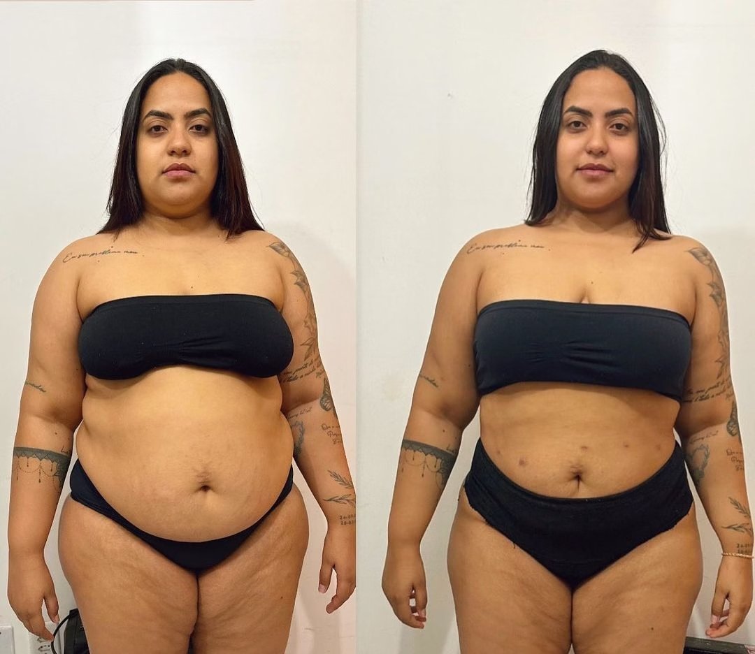 apos-perder-60-kg,-verolayne-abre-o-jogo-sobre-cirurgias-e-autoestima