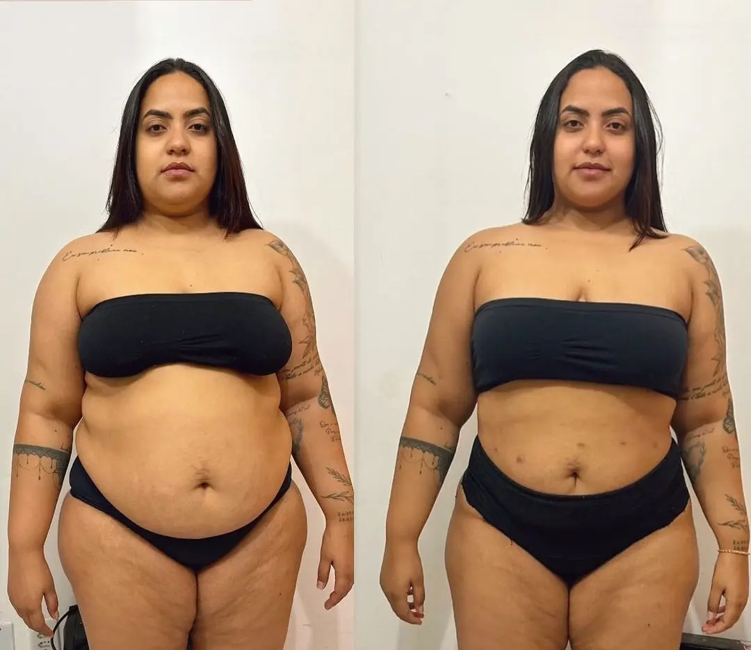Após perder 60 kg, Verolayne abre o jogo sobre cirurgias e autoestima