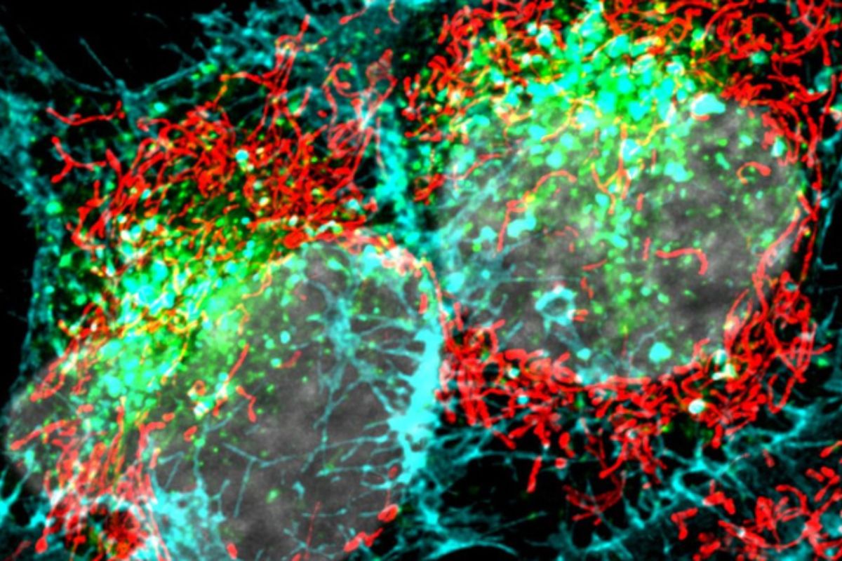 pesquisadores-da-usp-criam-ia-que-preve-a-agressividade-de-tumores