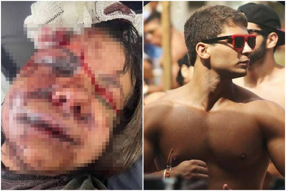 “focar-na-recuperacao”,-diz-mulher-que-levou-60-socos-de-ex-atleta