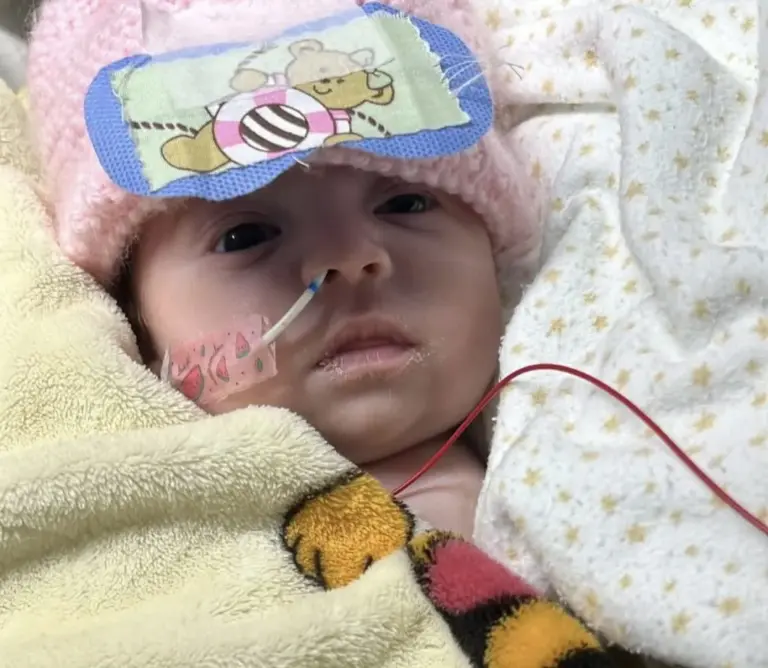 Caso Aurora: após enxerto, bebê vai passar por nova avaliação; médicos não descartam amputação