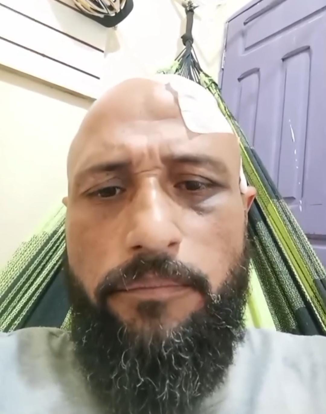 Ex-dançarino dos Cobras Dance desabafa após garrafada na cabeça: “Joguei minha história no lixo?”