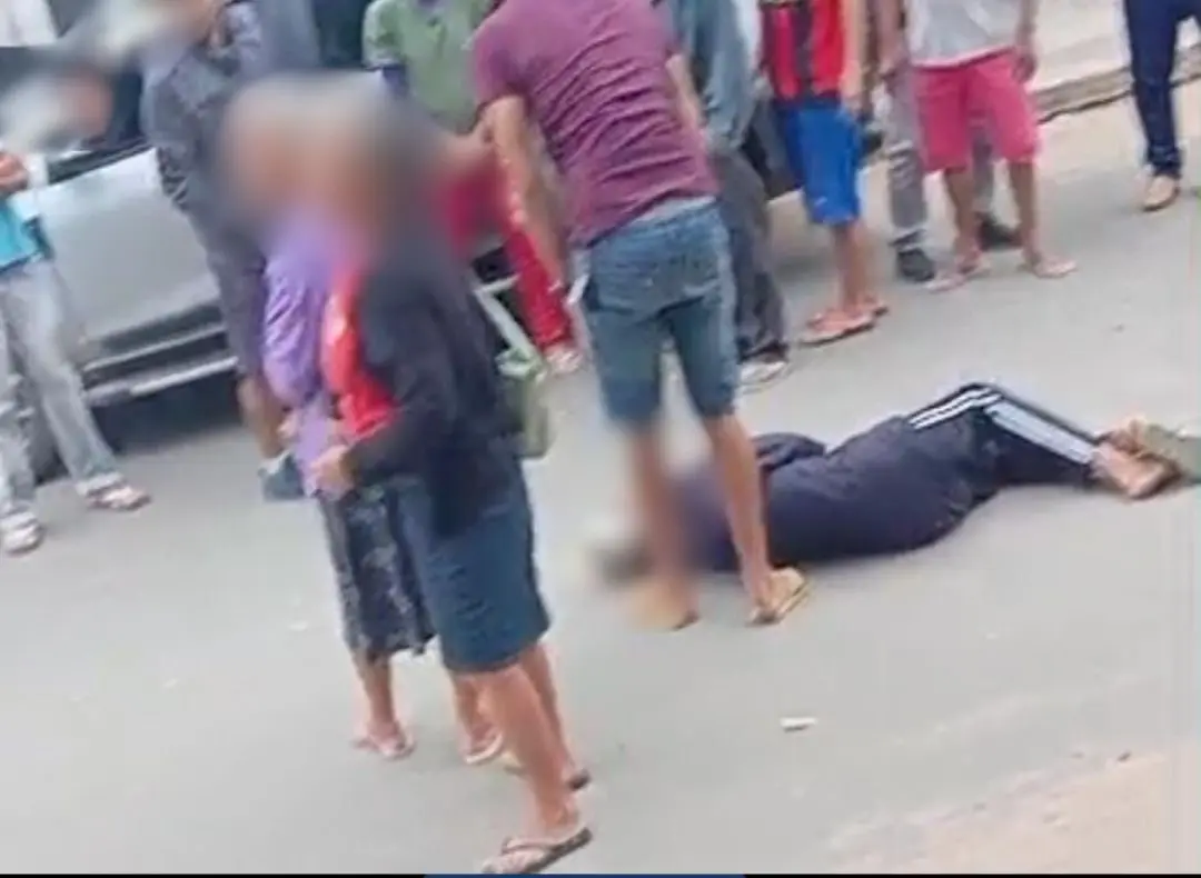 Idoso é atropelado por menor em Guajará no Amazonas; vítima é internada grave no Hospital do Juruá