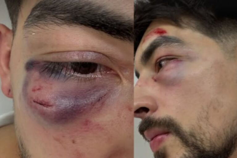 Empresário denuncia agressão por funcionários de karaokê em São Paulo