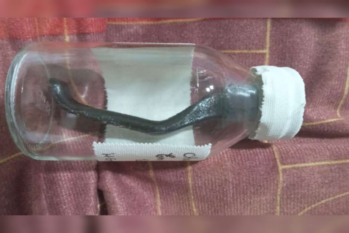 ciclista-atropelado-fica-9-meses-com-peca-de-bicicleta-na-barriga