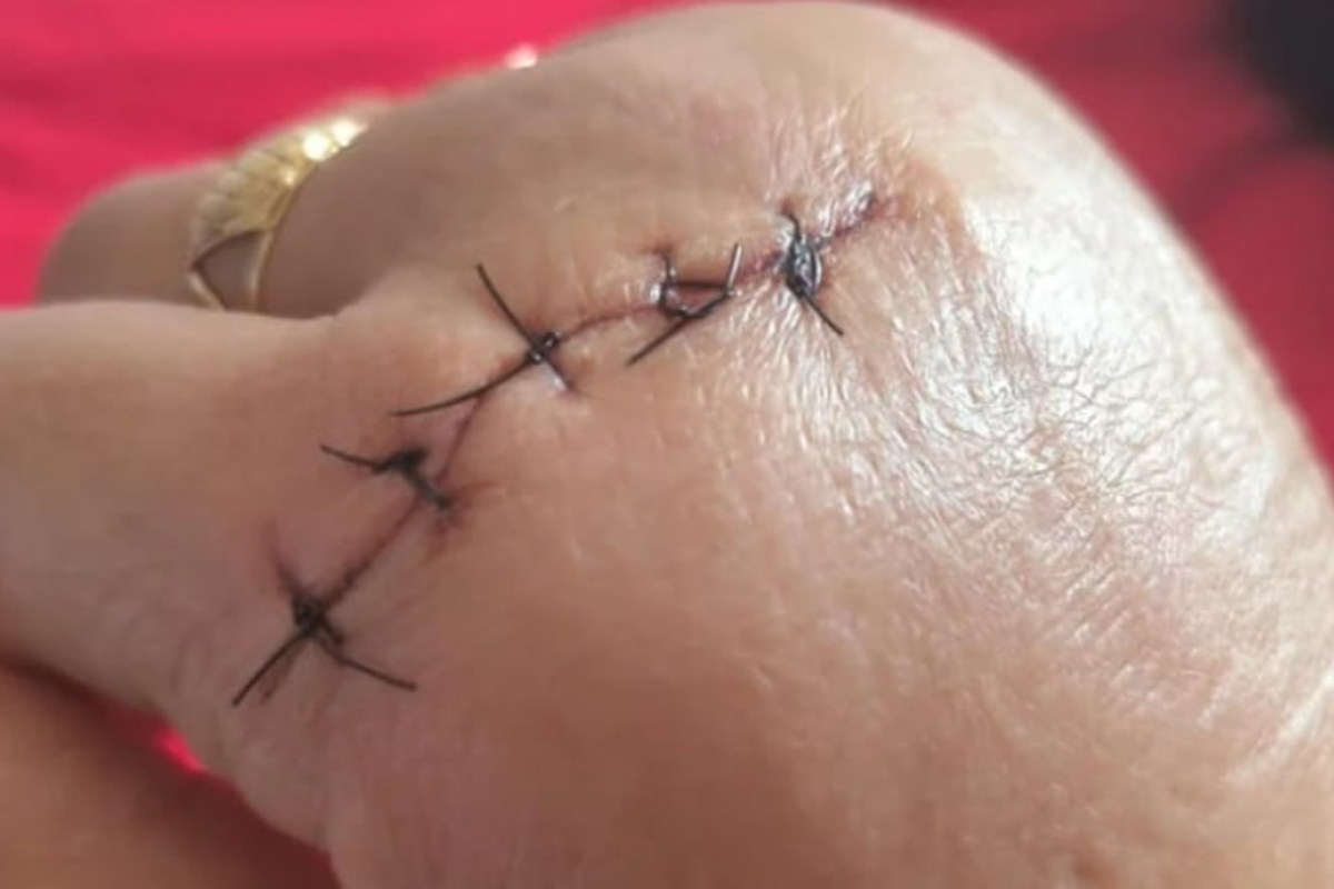 “vou-te-matar”:-aluna-ataca-professora-com-golpes-de-faca-em-escola